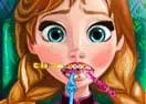 Jogar Anna Tooth Injury