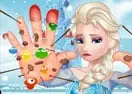 Elsa Hand Doctor