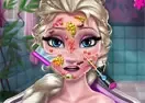 Jogar Elsa Skin Doctor