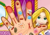 Jogar Rapunzel Hand Doctor