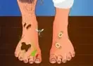 Jogar Smelly Feet Surgery